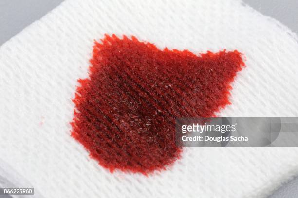 blood covered wound gauze - gauze stock pictures, royalty-free photos & images
