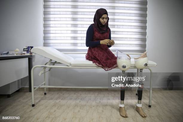 Year-old Syrian refugee Naghan Alwan , fled from Syria's Idlib due to ongoing civil-war, poses at a medical center after she got her prothesis legs...