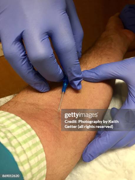 preparation for an intravenous line in a hospital - iv going into an arm stock pictures, royalty-free photos & images