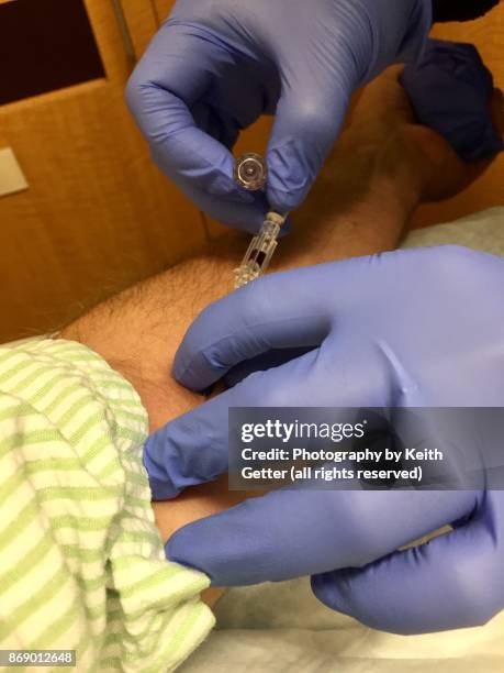 preparation for an intravenous line in a hospital - inserting iv stock pictures, royalty-free photos & images