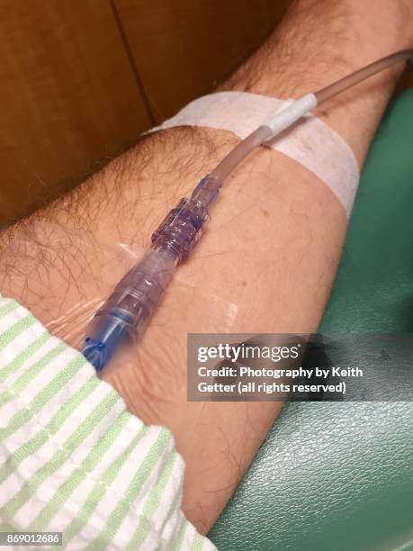 an unrecognizable person with an intravenous line in their arm - inserting iv stock-fotos und bilder