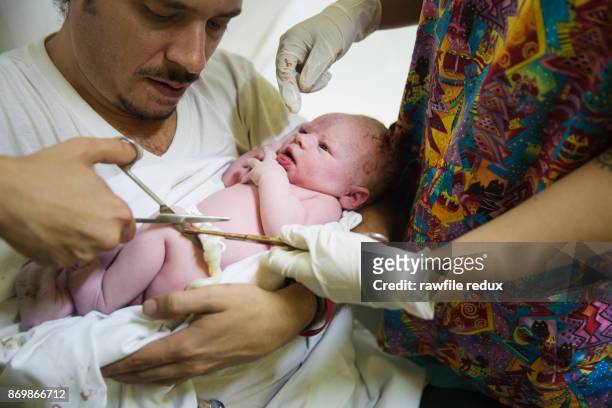 a new born baby - umbilical cord 個照片及圖片檔