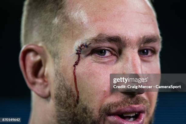 New Zealands Luke Romano shows the scars of battle after the Killik Cup match between Barbarians and New Zealand at Twickenham Stadium on November 4,...