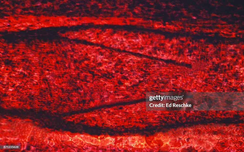 VALVE in a LYMPHATIC VESSEL insuring one-way flow of lymph in the vessel, longitudinal section 25X