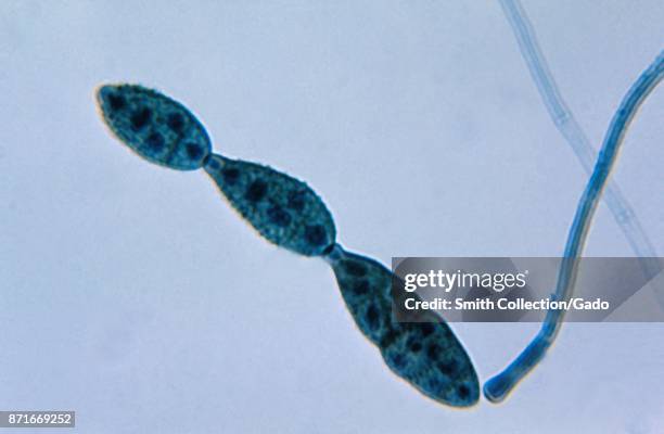 Chain of conidia of a Alternaria sp fungus, which can be a cause of phaeohyphomycosis, 1955. Image courtesy CDC/Dr Lucille K Georg. Image courtesy...