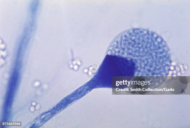 Light micrograph of mature sporangium of a Mucor fungus, 1955. Image courtesy CDC/Dr Lucille K Georg. Image courtesy CDC.