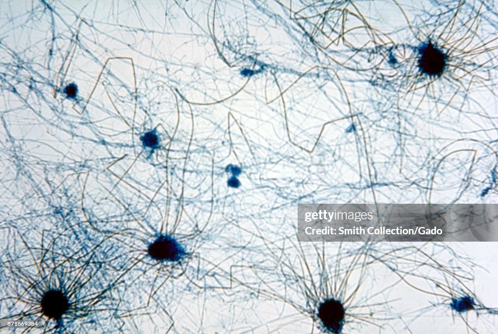Perithecia