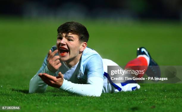 England's Bobby Duncan appeals to the linesman as he bleeds from the mouth during the Under 17 international match at the Proact Stadium,...