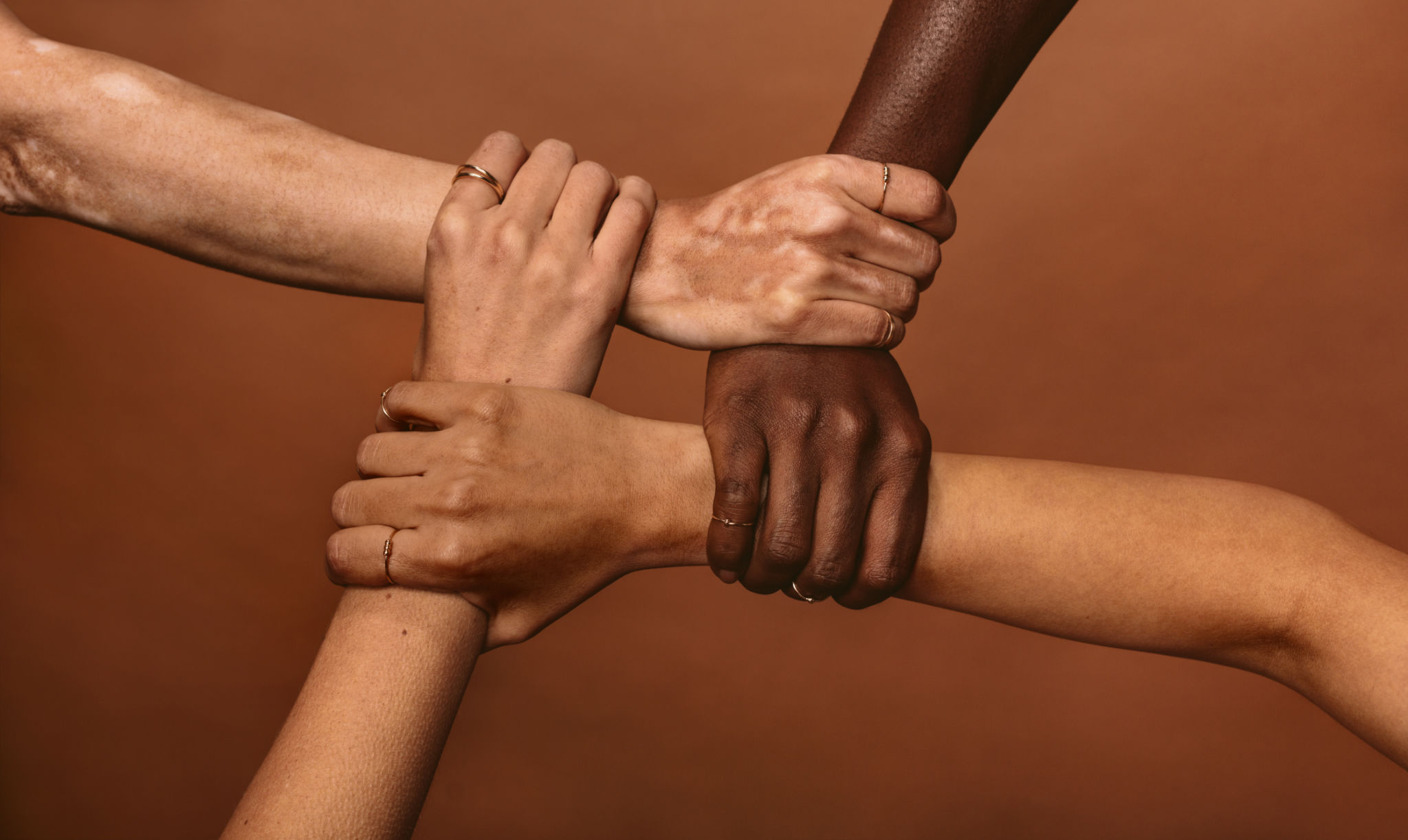 racial disparities