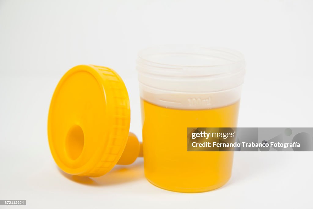 Urine analytical