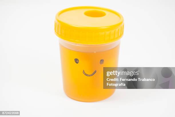 urine analytical - urine stockfoto's en -beelden