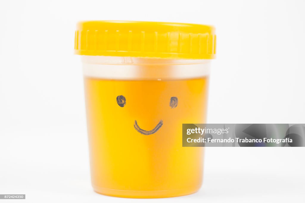 Urine analytical