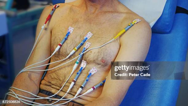mans upper body undergoing ecg in hospital - heart beat stock pictures, royalty-free photos & images