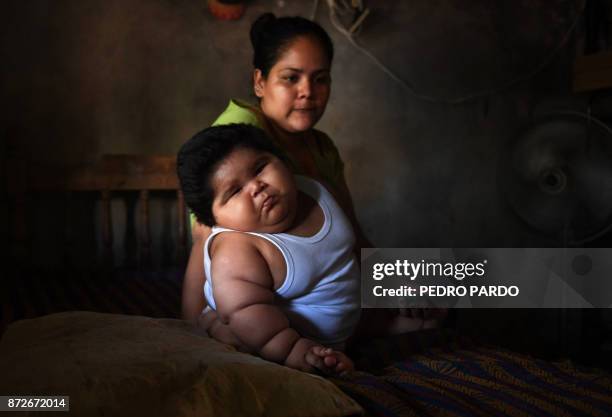 Ten-month-old Luis Gonzales and his mother Isabel Pantoja are pictured at their home in Tecoman, Colima state, Mexico on November 8, 2017. Luis...