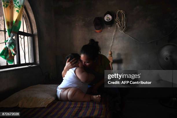 Ten-month-old Luis Gonzales is cuddled by his mother Isabel Pantoja at their home in Tecoman, Colima state, Mexico on November 8, 2017. Luis Manuel...
