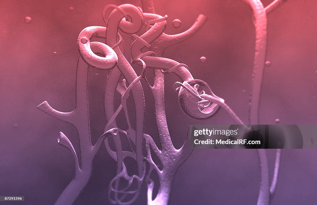 Glomerulus