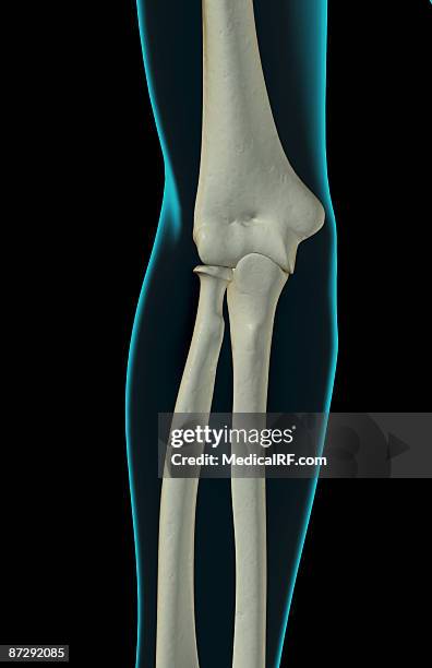 Condyle Pin Elbow 71 Lateral Condyle Stock Photos, High-Res Pictures, and Images - Getty ...