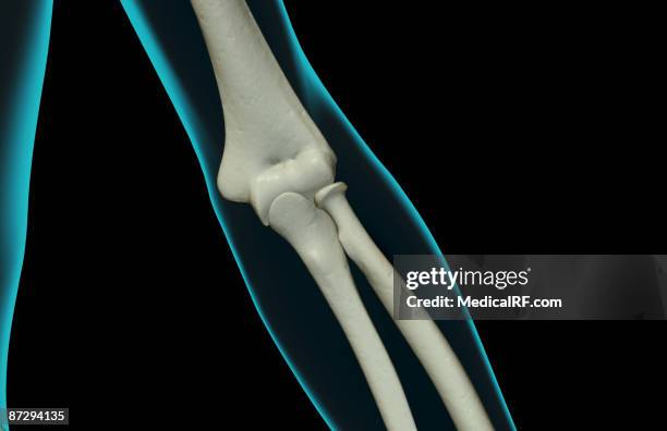 Condyle Pin Elbow 71 Lateral Condyle Stock Photos, High-Res Pictures, and Images - Getty ...