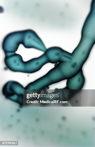 Ebola virus Ebola virus