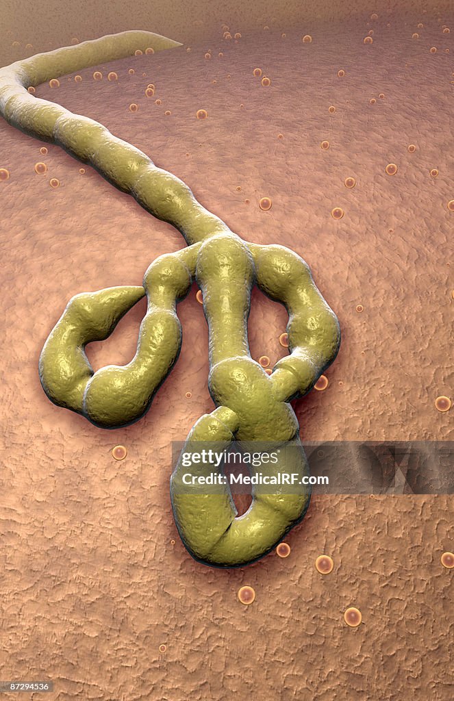 Ebola virus