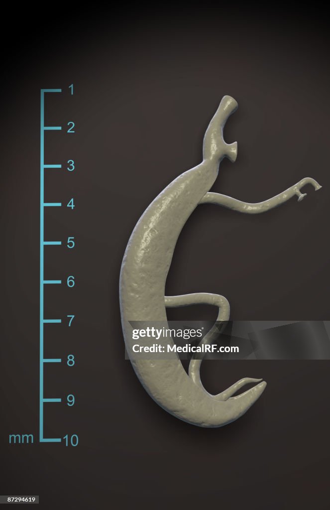 Schistosoma