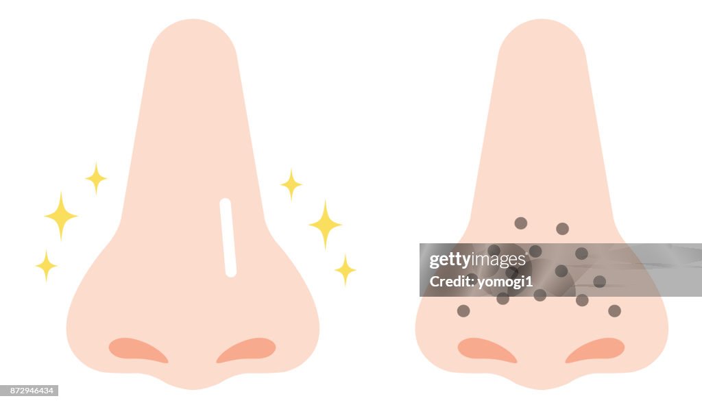 Cartoon Illustration Of Clogged Pores And Clean Pores On Nose High-Res  Vector Graphic - Getty Images