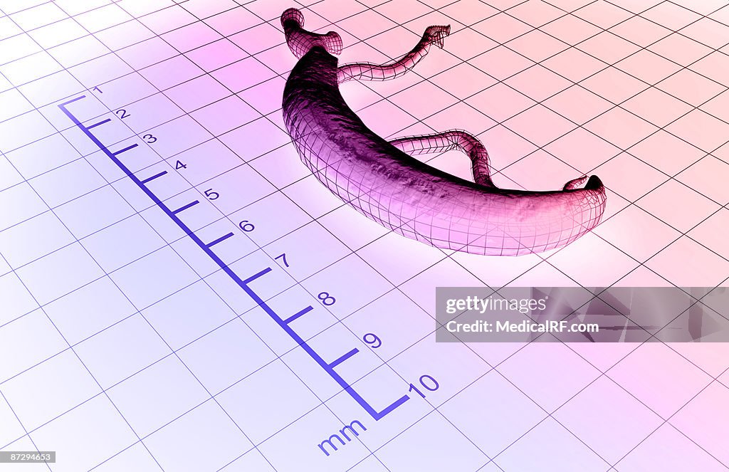 Schistosoma