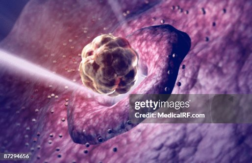 Ovulation Ovulation
