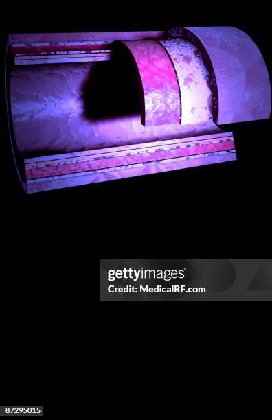 the arterial wall - endothelial stock illustrations