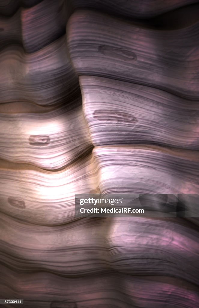 Tendon tissue