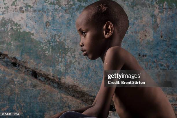 Yahya Jimale Kheyliye was one of nine children who were hit by an Al-Shabab mortar that was fired at the presidential compound on the day the new...