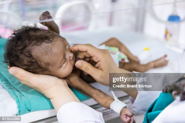 Nurses attend premature babies inside the new neo-natal unit at the Turkish built and run hospital in Mogadishu. The child in this image weighed only...