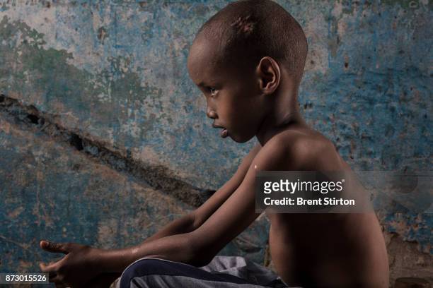 Yahya Jimale Kheyliye was one of nine children who were hit by an Al-Shabab mortar that was fired at the presidential compound on the day the new...