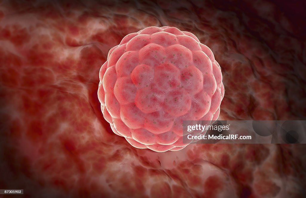 Implantation