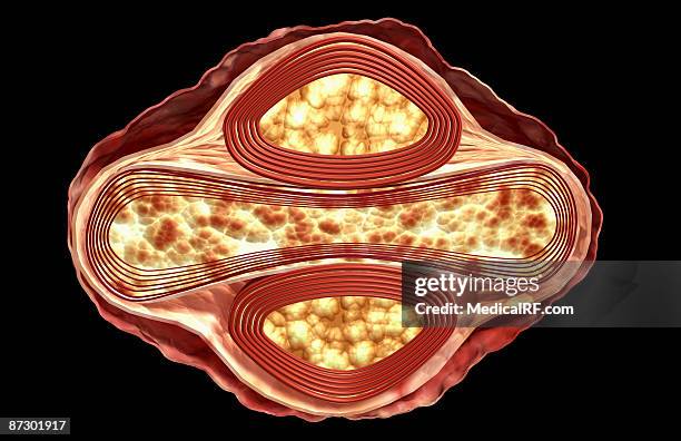 smallpox virus - smallpox stock illustrations