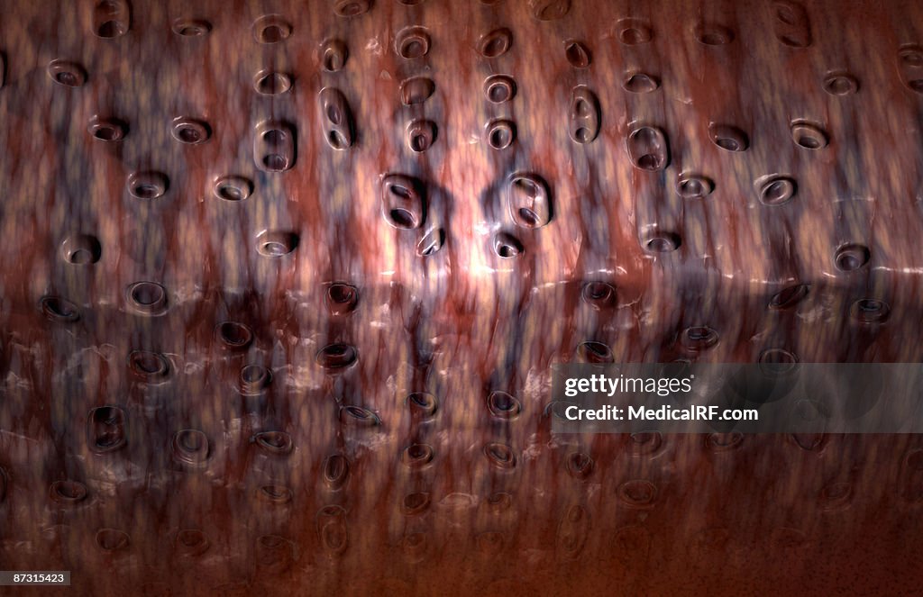 Fibrocartilage