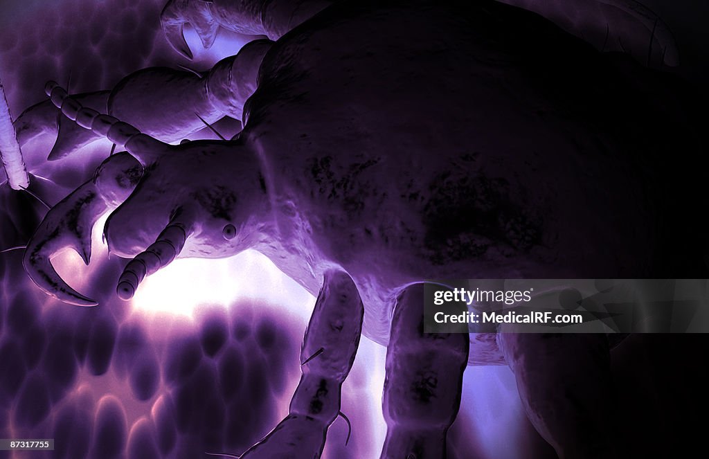 Pubic louse