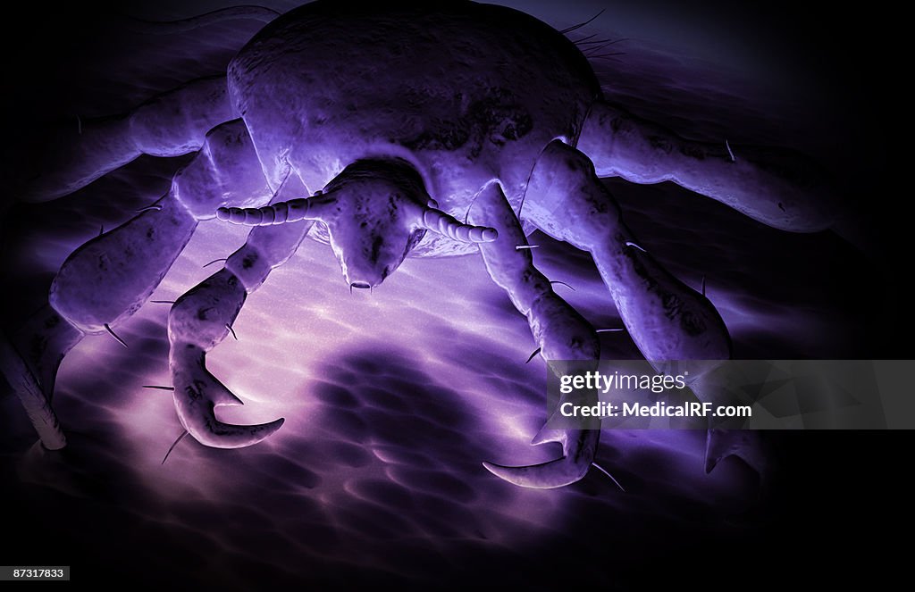 Pubic louse