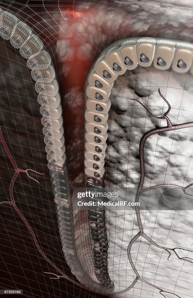 Gastric pit