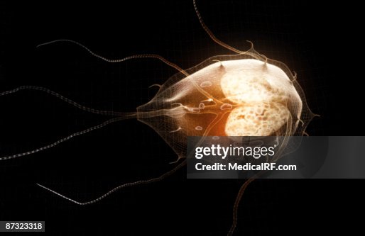 Giardiasis Giardiasis