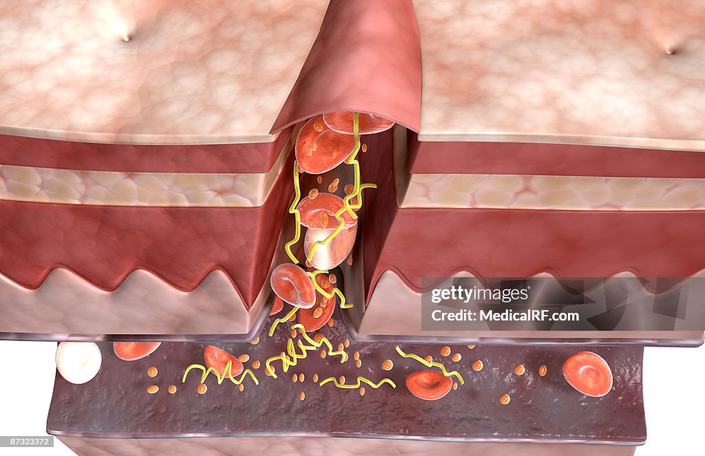 Blood clot formation