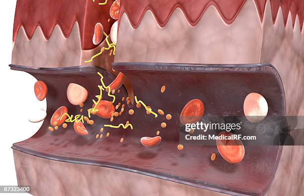 ilustrações, clipart, desenhos animados e ícones de blood clot formation - fibrin