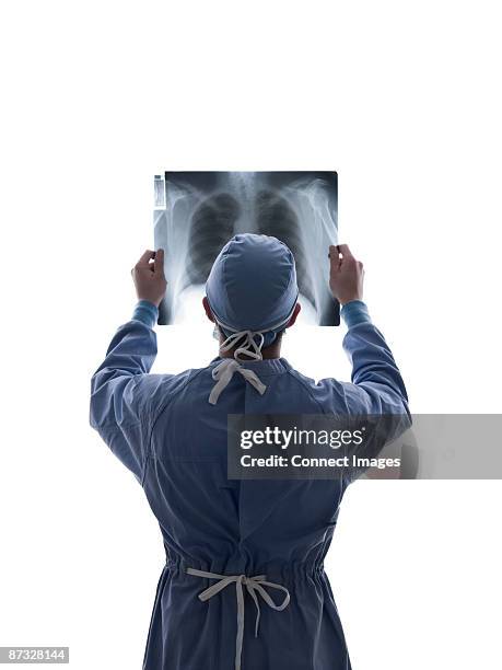 surgeon looking at x-ray - operatiegewaad stockfoto's en -beelden