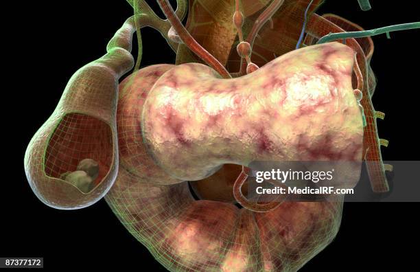 gallstones - gall stone stock illustrations
