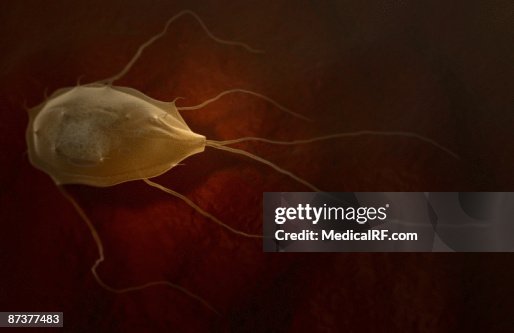Giardiasis Giardiasis