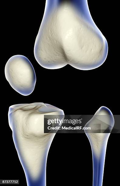 22 Medial Tibial Condyle Stock Photos, High-Res Pictures, and Images ...
