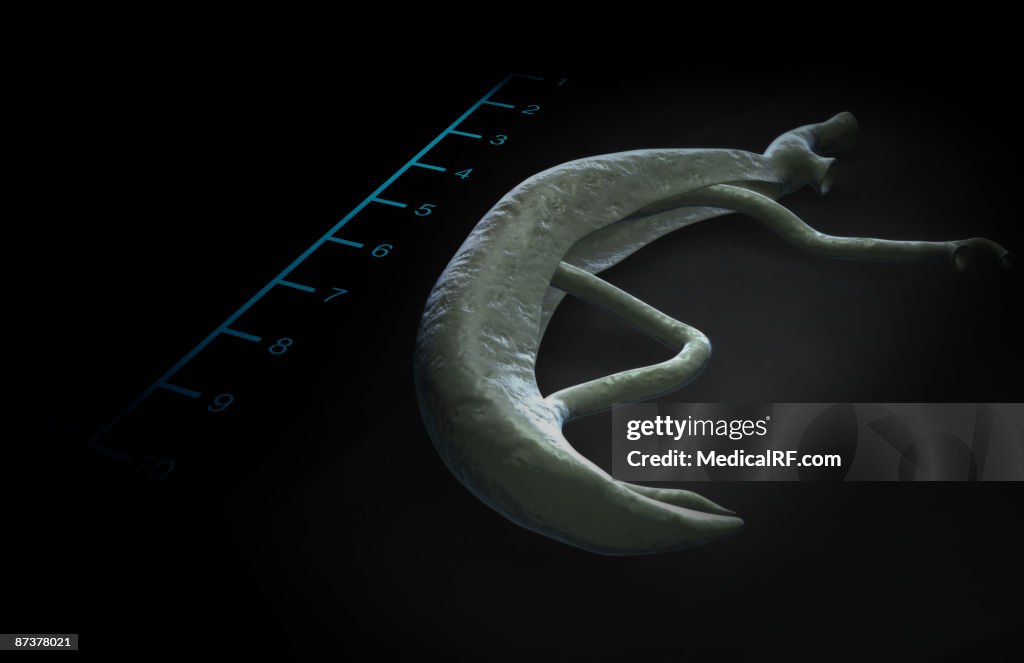 Schistosoma