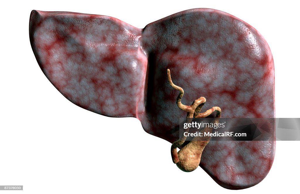 Gall bladder and liver