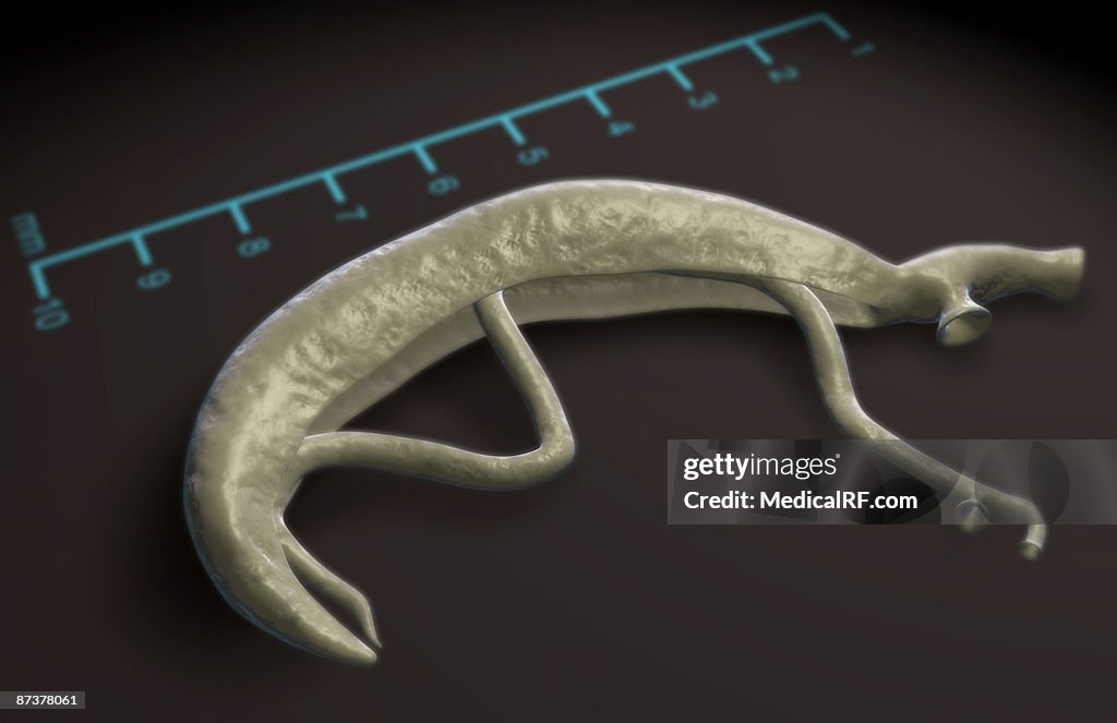 Schistosoma