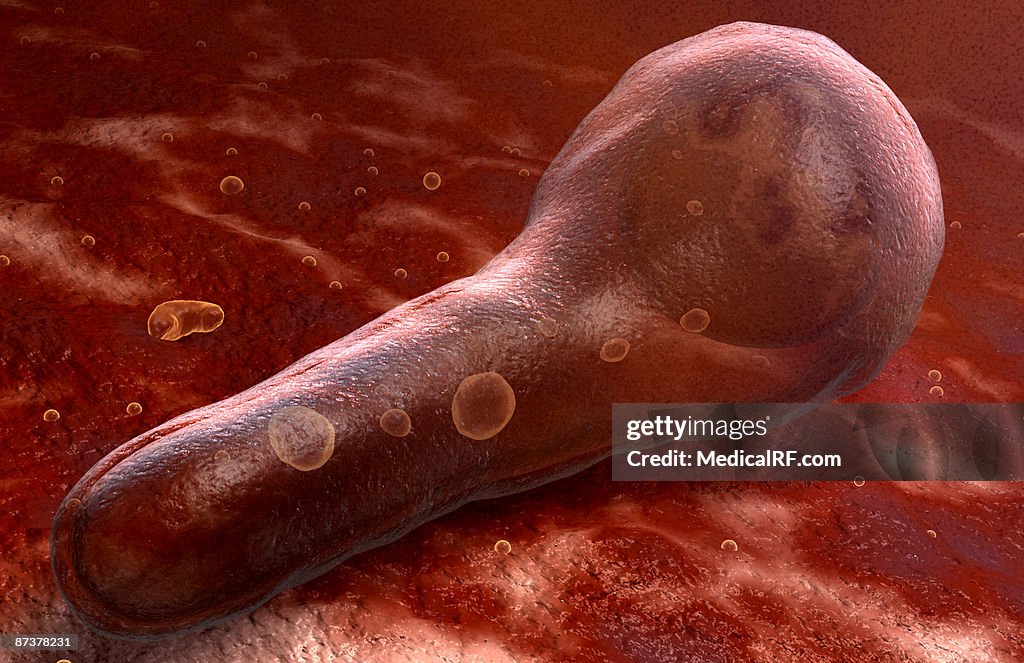 Tetanus Graphics Tetanus Bacteria High-Res Vector Graphic - Getty Images